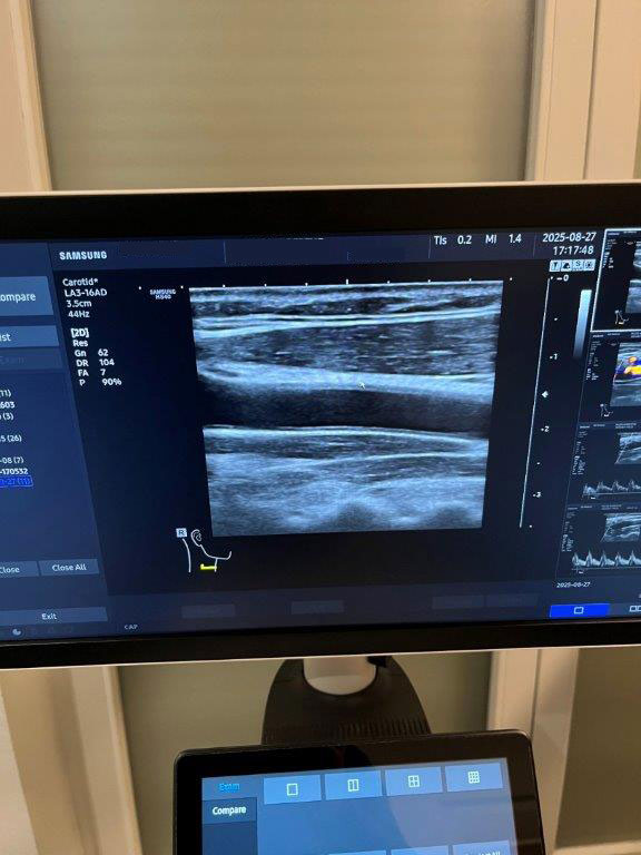 Használt HS40 ultrahang készülék négy vizsgálófejjel szülészeti, nőgyógyászati és radiológiai célra