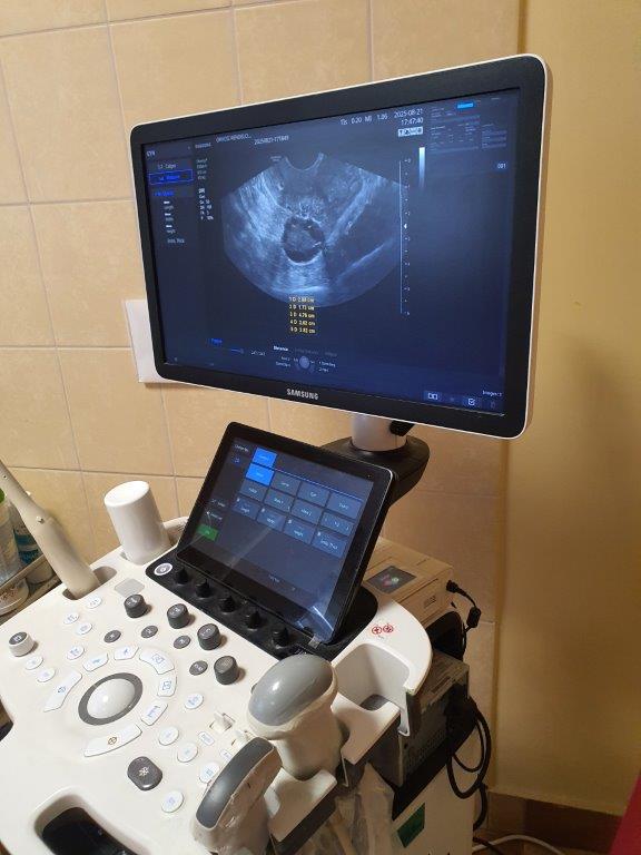 Használt Samsung Medison HS40 típusú ultrahang készülék 2D/3D/4D/5D hasi vizsgálófejjel