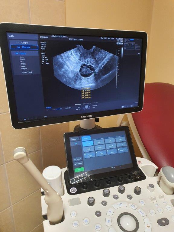 Használt Samsung Medison HS40 típusú ultrahang készülék nőgyógyászati vizsgálófejjel