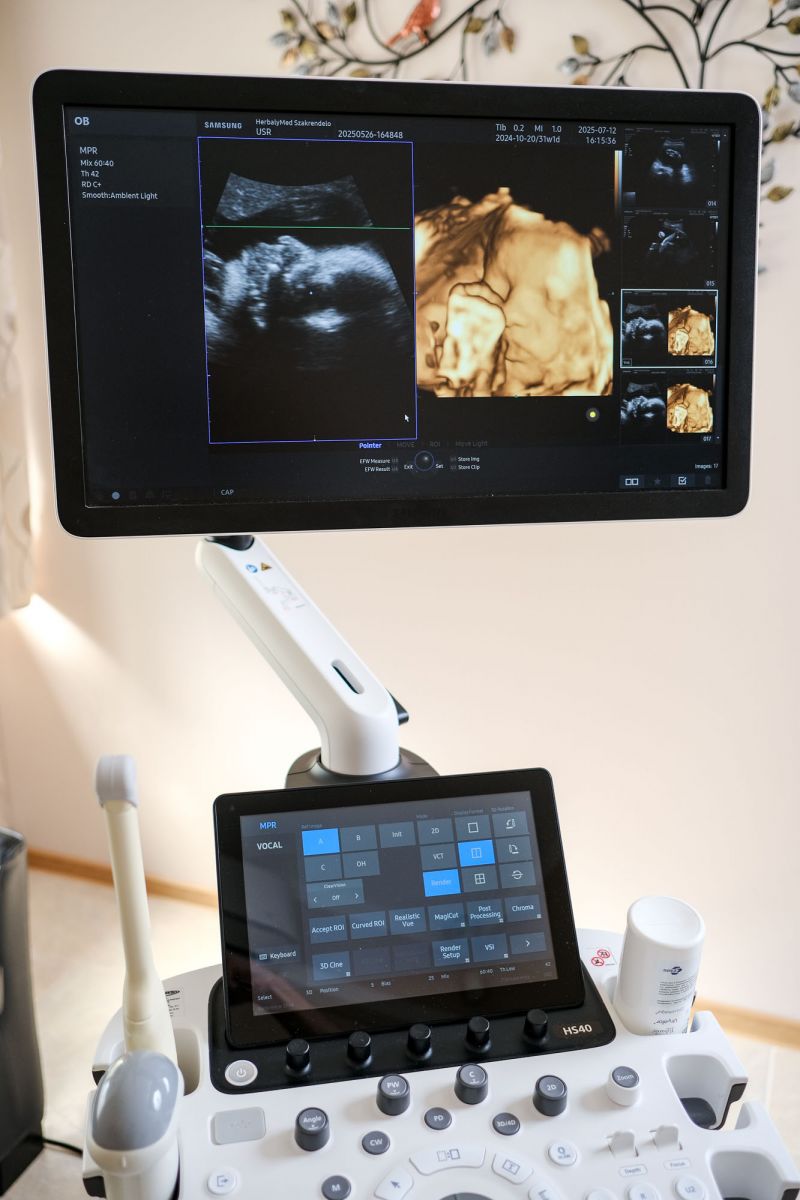 Használt HS40 ultrahang készülék 3D/4D/5D hasi + 2D nőgyógyászati vizsgálófejjel