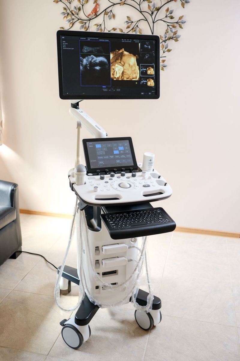 Használt HS40 ultrahang készülék 3D/4D/5D hasi + 2D nőgyógyászati vizsgálófejjel