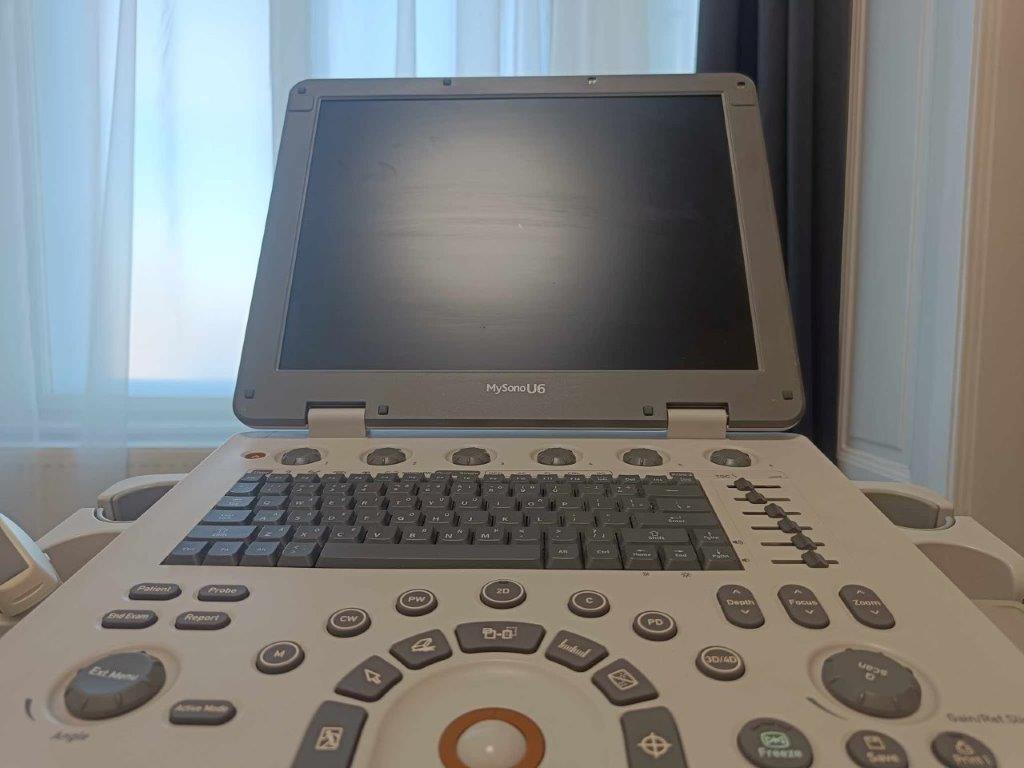 Samsung Medison MySonoU6 hordozható ultrahang készülék hasi vizsgálófejjel