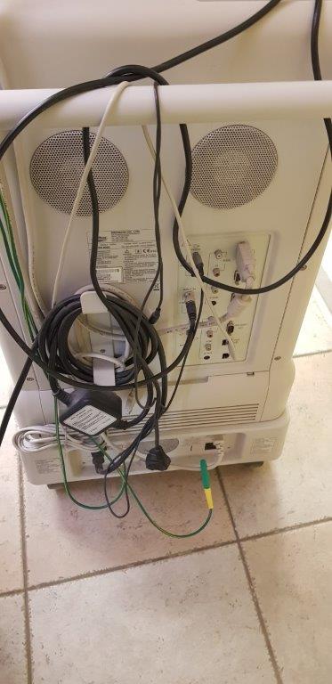 Használt Medison SonoAce 8000EX ultrahang készülék hátulja