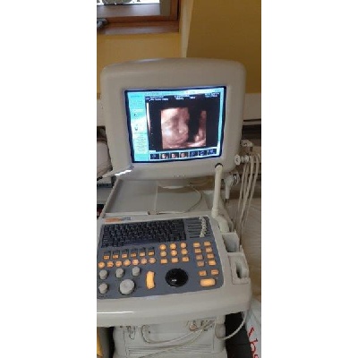 Használt SonoAce 8000LV típusú ultrahang készülék